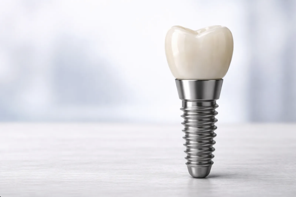 implantes dentales en tomares